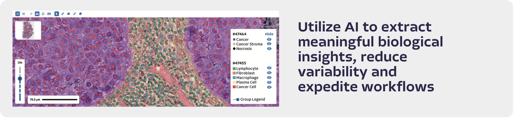 Pathai Launches Ai Powered Her2 Scoring Algorithm - Mountain Backgrounds - Artistic Full HD Collection